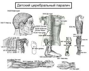 Рисунок1